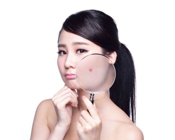 comment se débarrasser des zits dans un mythe au jour le jour sur l'acné