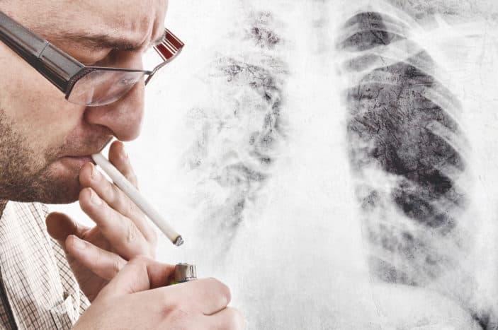 symptômes du cancer du poumon