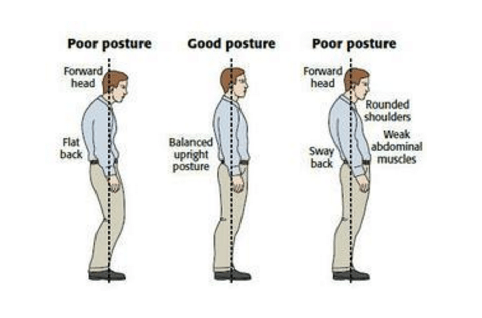 Source de l'image: http://www.thephysiocompany.com/blog/stop-slouching-postural-dysfunction-symptoms-causes-and-treatment-of-bad-posture