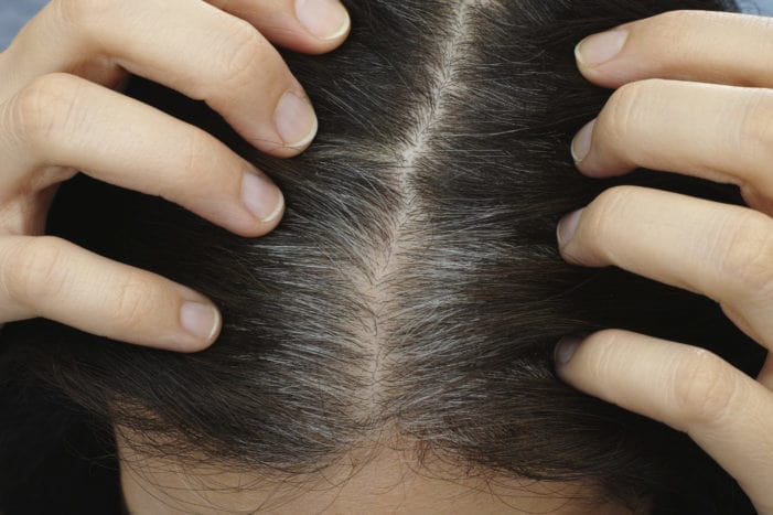 cheveux gris non seulement sur la tête