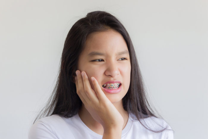 orthèse de dent