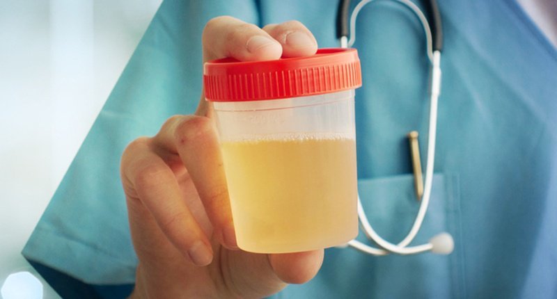 le liquide amniotique et l'urine