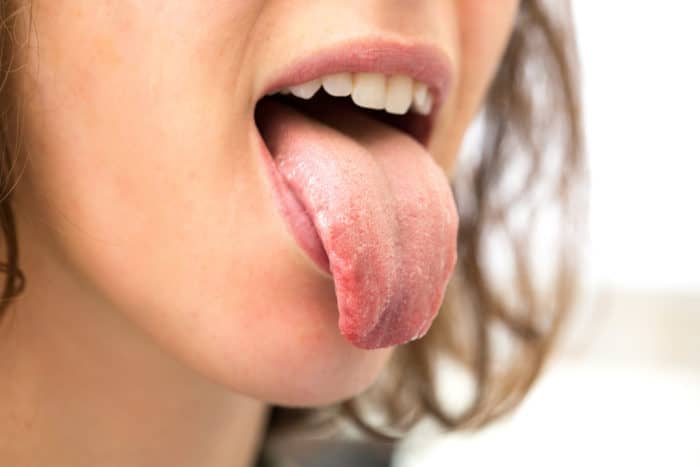 la cause des démangeaisons de la langue