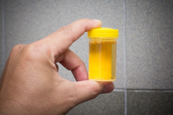thérapie d'urine à boire de l'urine