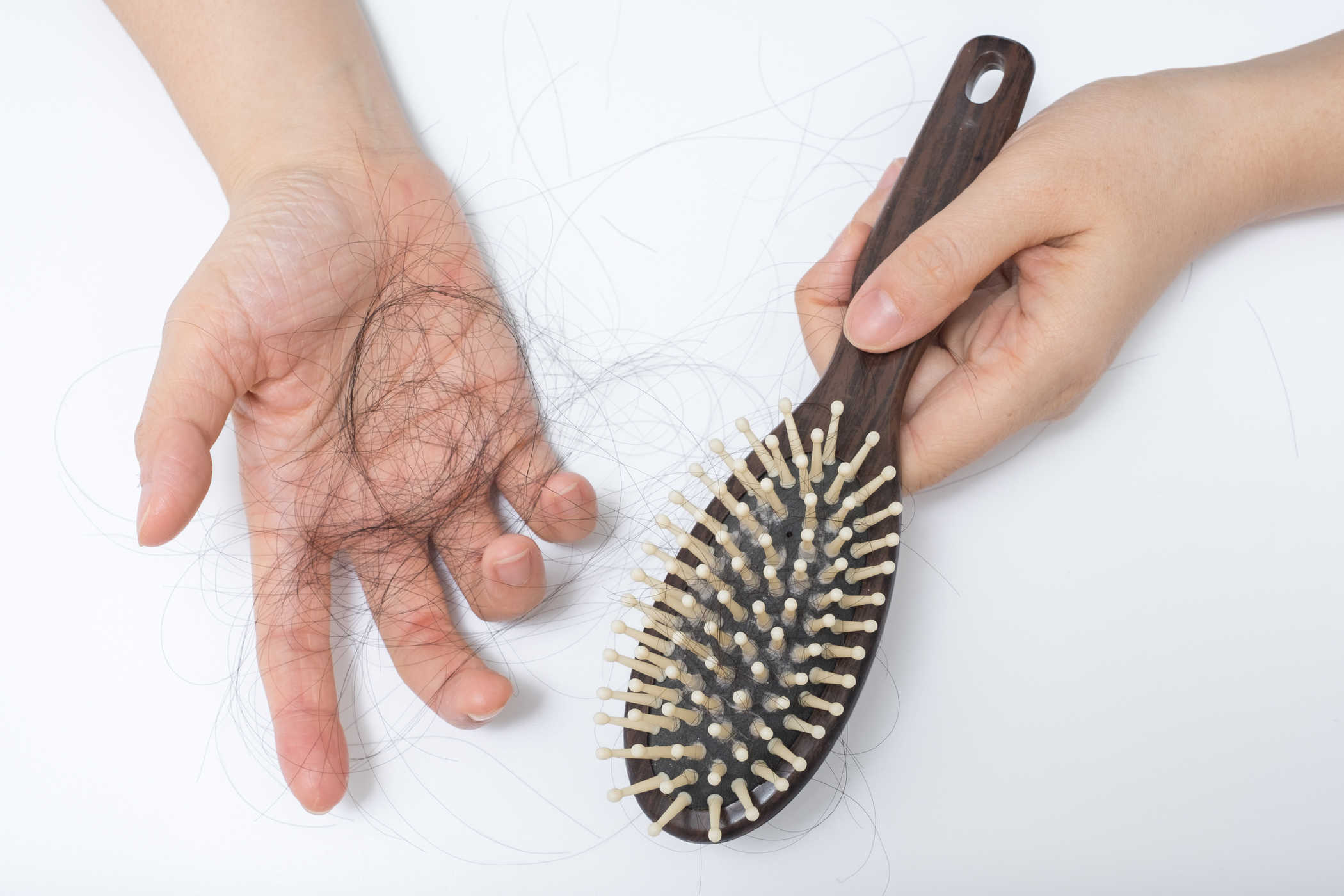 calvitie perte de cheveux après l'accouchement